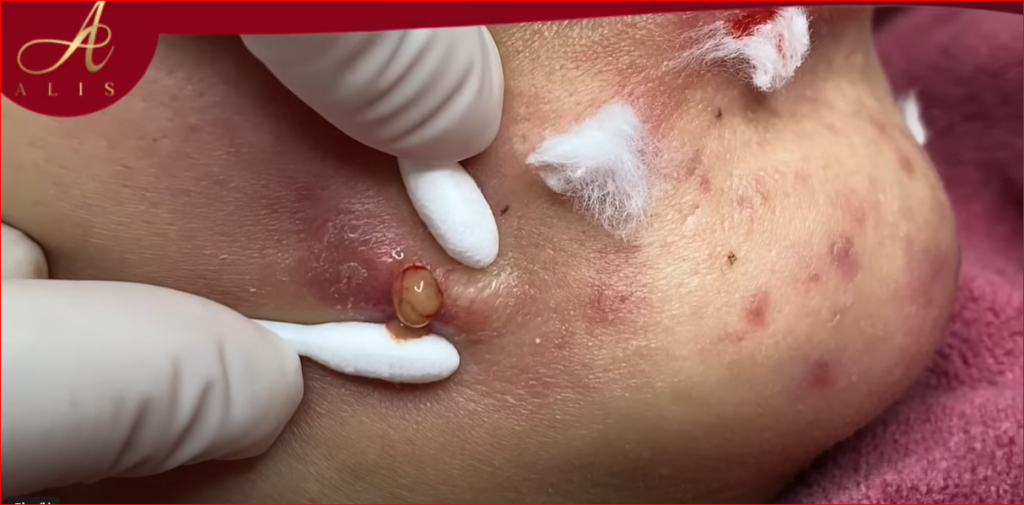 The Ultimate Guide to Skin Care: Expert Tips and Tricks for Every Skin Type