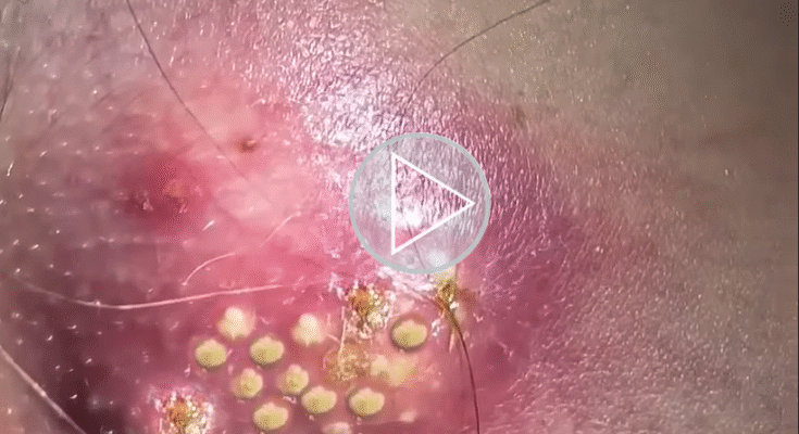 Comprehensive Guide to Tumor Treatment Options: Methods, Applications, and References